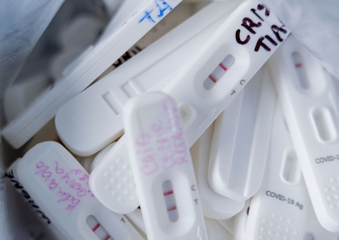 Ministério envia à Anvisa informações sobre autotestes de covid-19