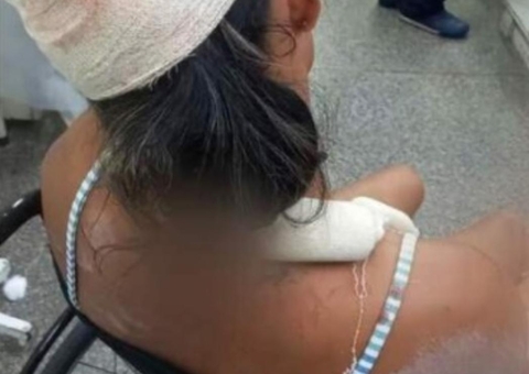 Sem aceitar separação, homem agride e quebra ossos de ex-mulher em Manaus