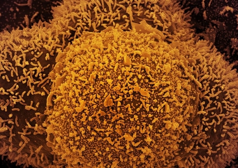 SP registra terceiro caso de subvariante mais infeciosa da Ômicron 