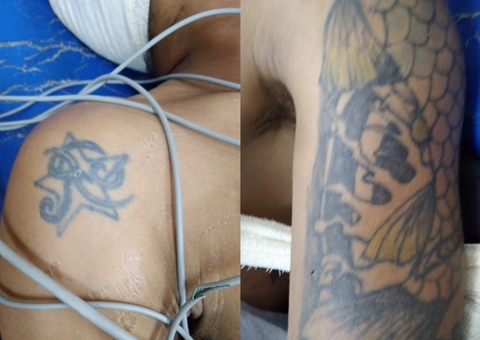 Hospital João Lúcio pede apoio para localizar família de paciente internado após agressão