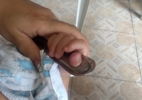 Bebê de 1 ano tem dedo preso em concha e Bombeiros são acionados em Manaus