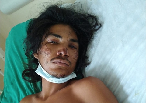 Hospital João Lúcio procura familiares de homem espancado em Manaus