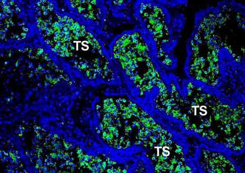 Pesquisa aponta que testículos podem se tornar 'santuário da Covid'