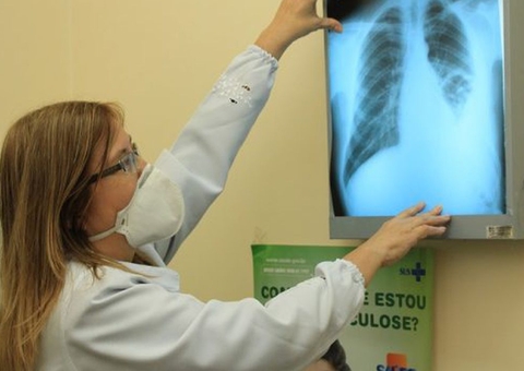Manaus registrou 542 casos novos de tuberculose nos três primeiros meses do ano