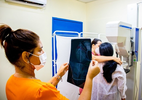 Sabadão da Saúde oferece preventivos, mamografia e consultas para mulheres em Manaus