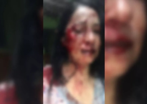 Mulher é espancada por 9 vizinhos após denúncia de som alto 