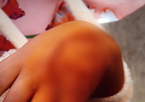 Criança sofre ferimento na mão durante visita ao pai em cadeia de Manaus