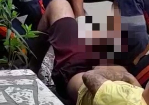 Homem tem joelho dilacerado em acidente ao tentar fugir com moto roubada em Manaus