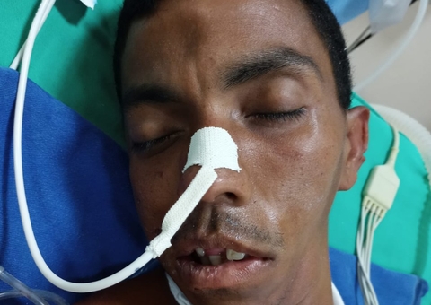 Hospital procura família de paciente que foi atropelado em Manaus