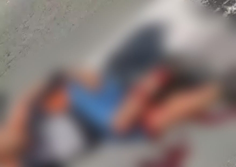Motociclista tem perna quebrada ao sofrer grave acidente em Manaus; vídeo