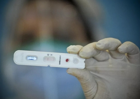 Brasil registra 11,7 mil casos de covid-19 e 36 mortes em 24 horas