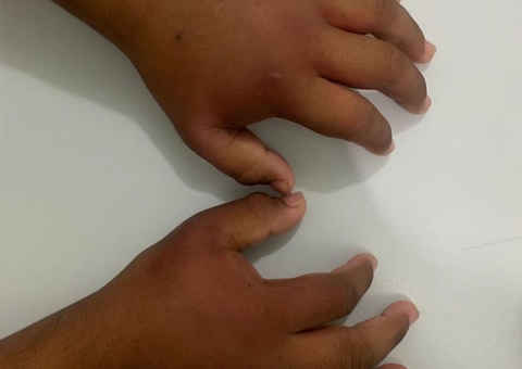 Criança urina sangue e leva diversas ripadas após tortura por pai em Manaus