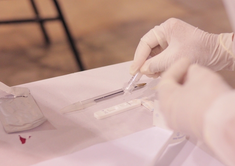 Semsa amplia postos de testagem após subida de casos de covid em Manaus