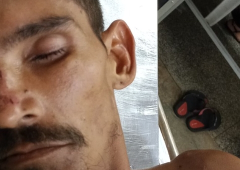 Hospital procura familiares de paciente atropelado em Manaus