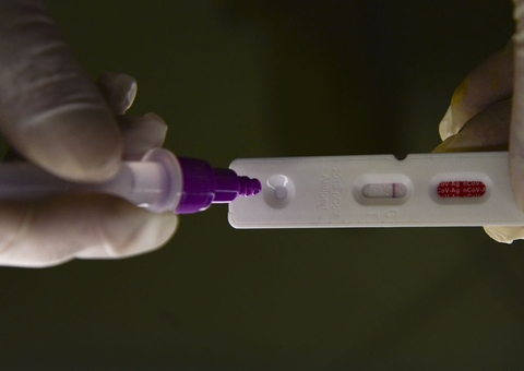 Brasil registra 18,5 mil novos casos e 53 mortes por covid-19