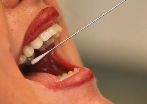 Novo vírus de origem animal surge na China e infecta 35 humanos 