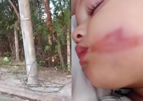 Bebês gêmeos levam 'chicotada' de fio elétrico após carro atingir cabos soltos