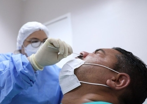 Amazonas registra 166 novos casos de Covid em 24h