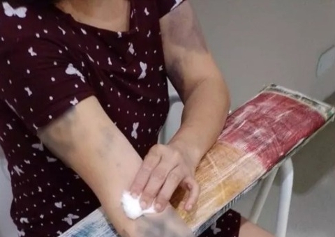 Com hematomas, mulher e filho de 4 anos são resgatados de cárcere privado