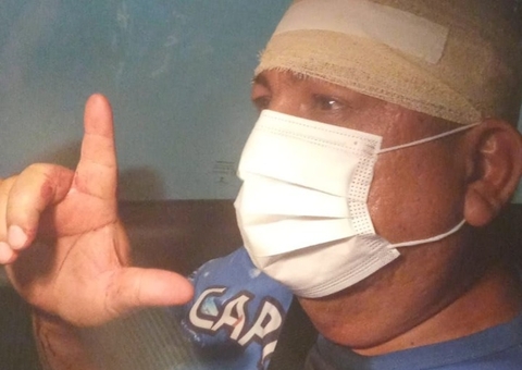 Assessor do deputado Zé Ricardo é agredido com barra de ferro por bolsonarista em Manaus