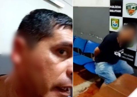 Homem arranca orelha a dentada de policial em quartel da PM no Amazonas; vídeo