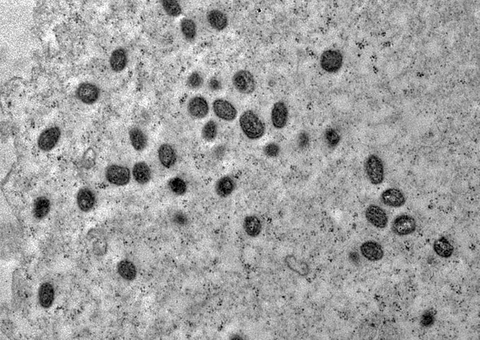 Minas Gerais tem segunda morte por varíola dos macacos confirmada