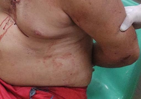 Homem 'ouve vozes' e dá facadas na esposa e na sogra em Manaus