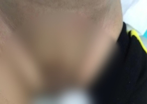 Em caso raro, bebê nasce sem pênis e faz xixi pelo ânus