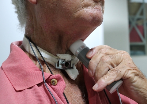 Pacientes que perderam voz após câncer na laringe recebem aparelho que auxilia na voz em Manaus