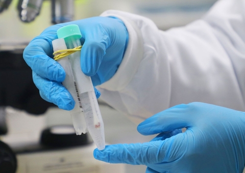 Saúde passa a processar exames de diagnóstico para monkeypox