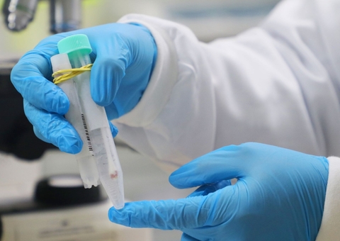 Amazonas registra 124 novos casos de Covid em 24 horas