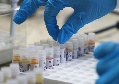 Sem mortes, Amazonas confirma 202 novos casos de Covid em 24h