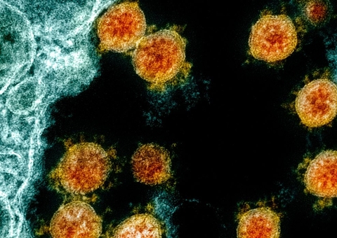 Sublinhagens de Covid são detectadas em São Paulo e Ribeirão Preto