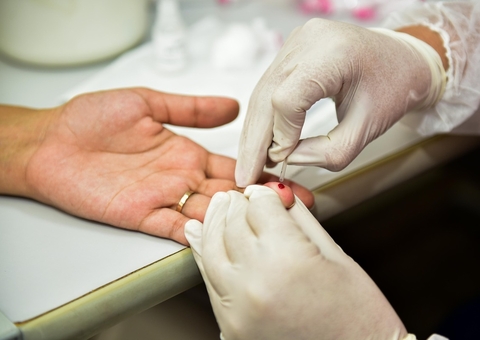 Amazonas tem mais de 200 casos de hepatites registrados; Saiba como se prevenir