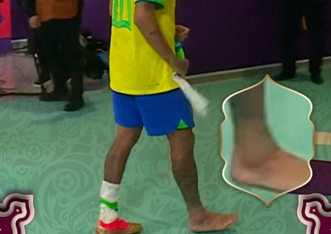 Neymar afastado? Entorse no tornozelo de atacante da Seleção Brasileira deixa dúvidas