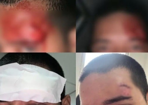 Estudante da Ufam sofre corte na cabeça após pular de ônibus para fugir de assalto em Manaus