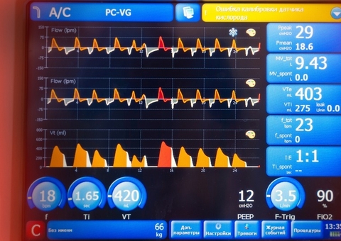 Mulher desliga respirador de outra paciente em hospital por se incomodar com barulho