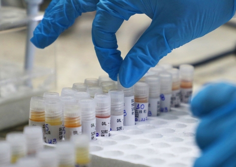 Covid-19: Amazonas registra uma morte e mais 12 infectados