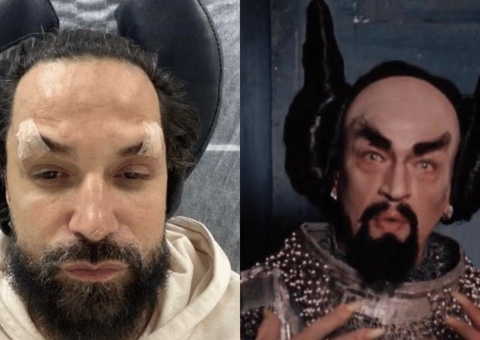 Latino desabafa após ser comparado a Diabo por rejuvenescimento facial