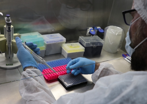 Amazonas confirma mais 2 casos de varíola dos macacos; total chega a 337