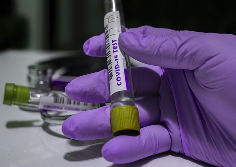 Covid-19: Brasil registra 28 mil casos e 211 mortes em 24 horas