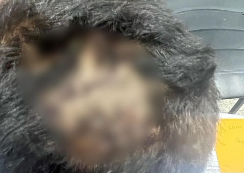 Criança tem cabeça quebrada após beber o mingau da irmã em Manaus 