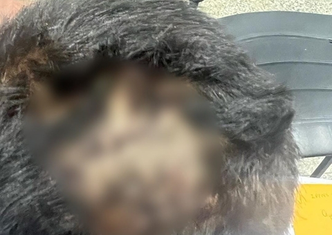 Padrasto usou faca para quebrar cabeça de menino que bebeu mingau da irmã em Manaus