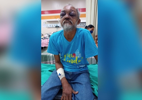 Hospital procura família de idoso internado após ser atropelado por ônibus em Manaus