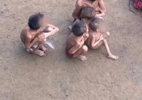 Yanomamis exibem sinais de desnutrição e de doenças como verminoses