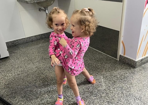 Gêmeas siamesas se reveem e dão as mãos pela 1ª vez após separação