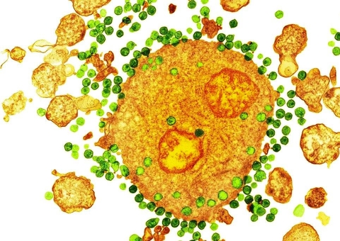 Novo paciente com HIV é curado após transplante de células-tronco, diz estudo