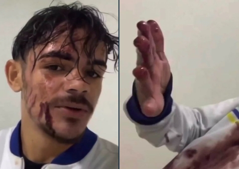 Cliente joga pote de açaí em motoboy por demora em entrega: "estava chovendo"