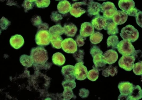 Homem morre após contrair ameba ao lavar o rosto