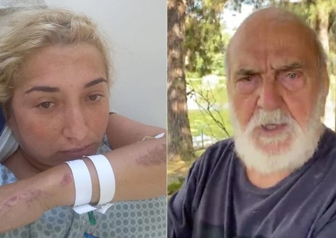 Lima Duarte atropela motociclista que tem cinco ossos quebrados